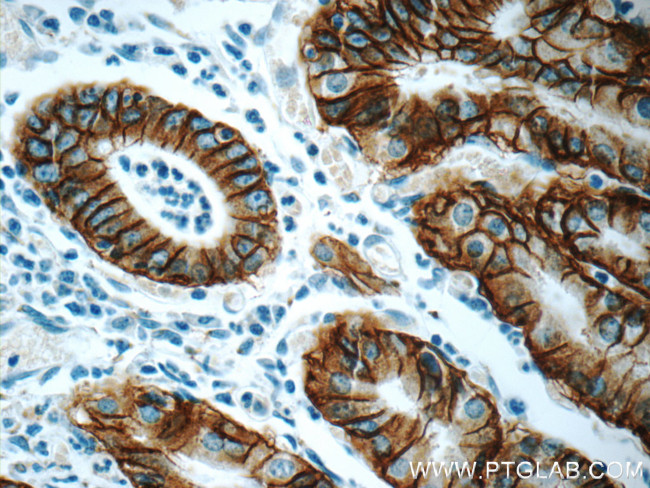 Claudin 18 Antibody in Immunohistochemistry (Paraffin) (IHC (P))