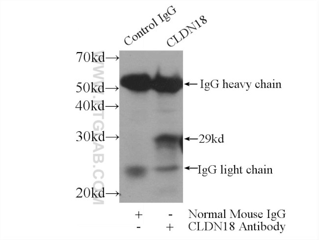 Claudin 18 Antibody in Immunoprecipitation (IP)