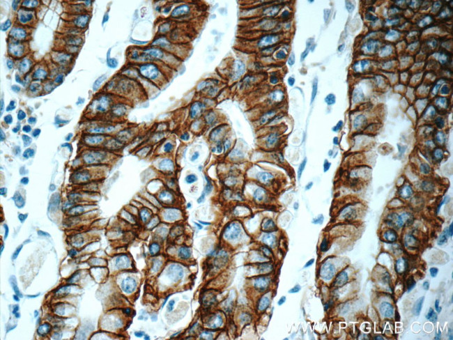 Claudin 18 Antibody in Immunohistochemistry (Paraffin) (IHC (P))