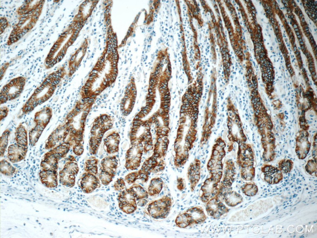 Claudin 18 Antibody in Immunohistochemistry (Paraffin) (IHC (P))