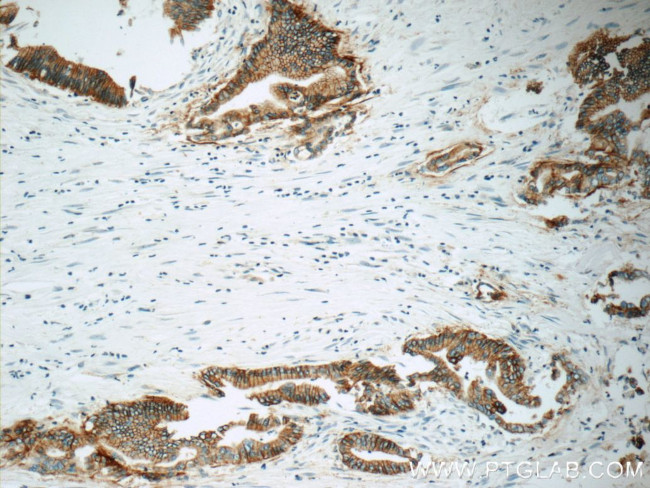 Claudin 18 Antibody in Immunohistochemistry (Paraffin) (IHC (P))