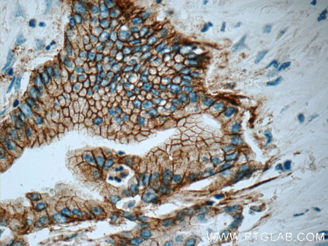 Claudin 18 Antibody in Immunohistochemistry (Paraffin) (IHC (P))