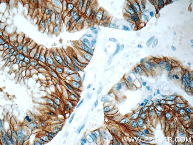 Claudin 18 Antibody in Immunohistochemistry (Paraffin) (IHC (P))