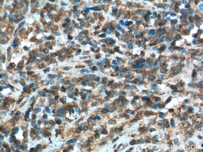 Caspase 9/p35/p10 Antibody in Immunohistochemistry (Paraffin) (IHC (P))