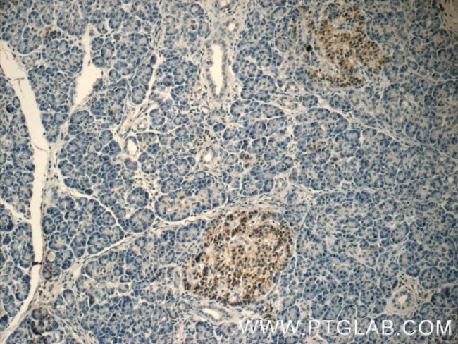 Caspase 9/p35/p10 Antibody in Immunohistochemistry (Paraffin) (IHC (P))