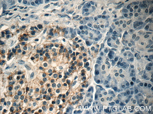 Caspase 9/p35/p10 Antibody in Immunohistochemistry (Paraffin) (IHC (P))