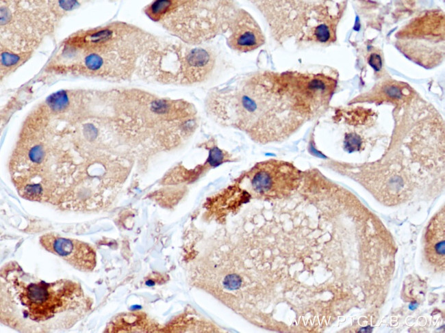 RCAS1 Antibody in Immunohistochemistry (Paraffin) (IHC (P))