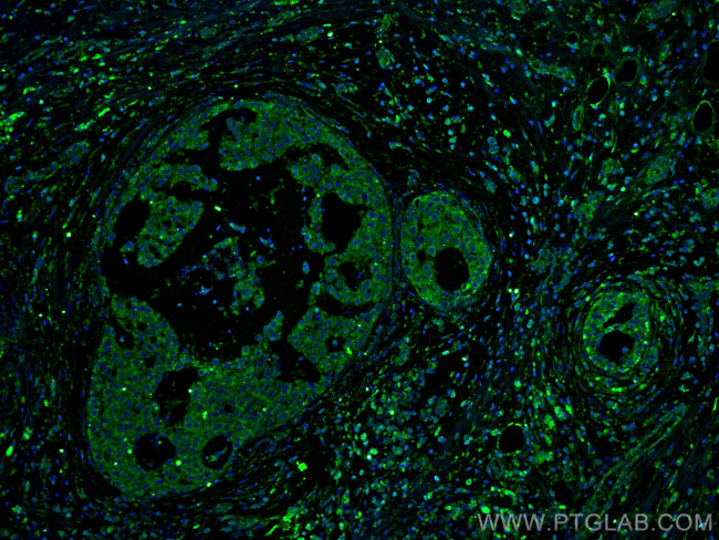 RCAS1 Antibody in Immunohistochemistry (PFA fixed) (IHC (PFA))