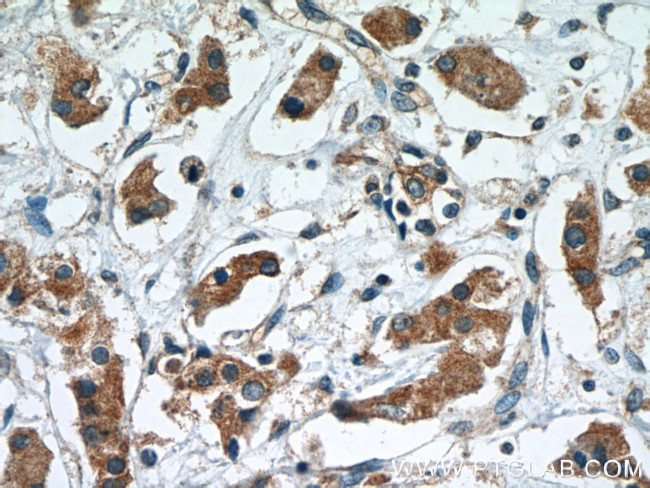 RCAS1 Antibody in Immunohistochemistry (Paraffin) (IHC (P))