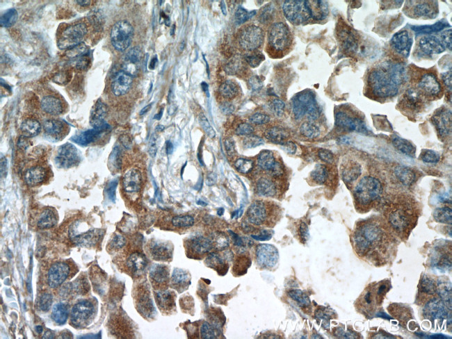 RCAS1 Antibody in Immunohistochemistry (Paraffin) (IHC (P))