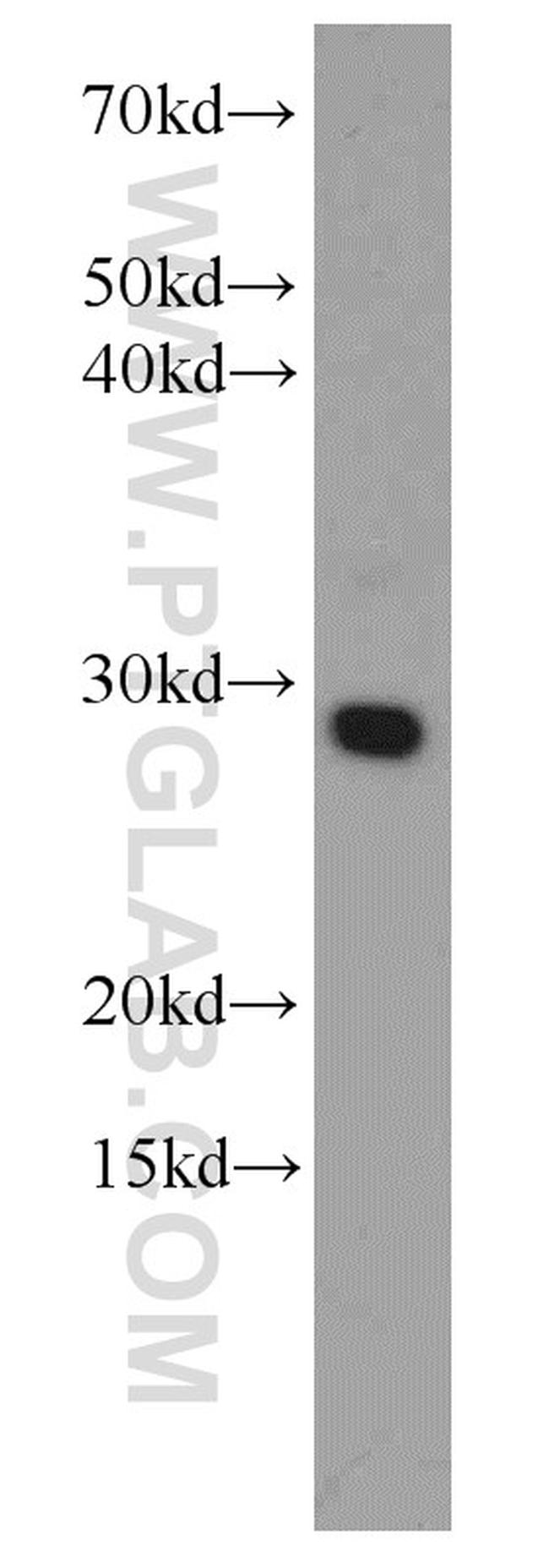 RCAS1 Antibody in Western Blot (WB)