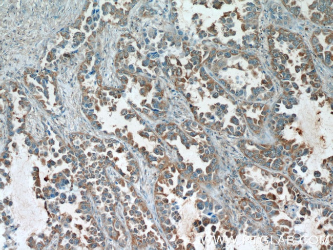 RCAS1 Antibody in Immunohistochemistry (Paraffin) (IHC (P))