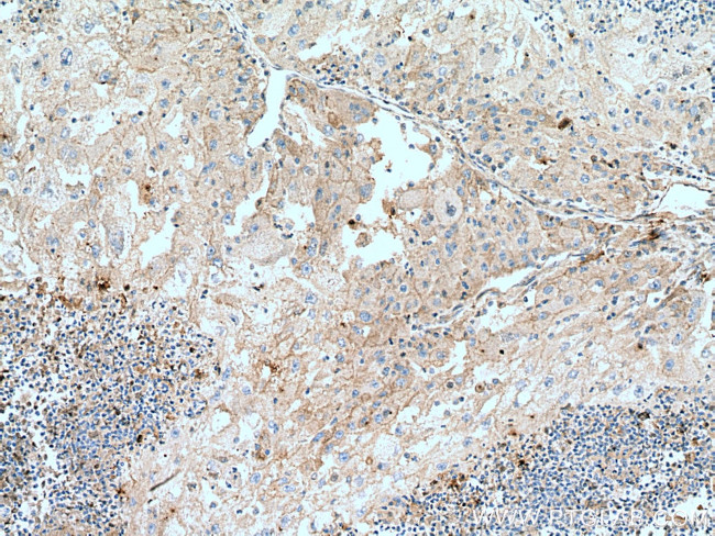 Transferrin Antibody in Immunohistochemistry (Paraffin) (IHC (P))