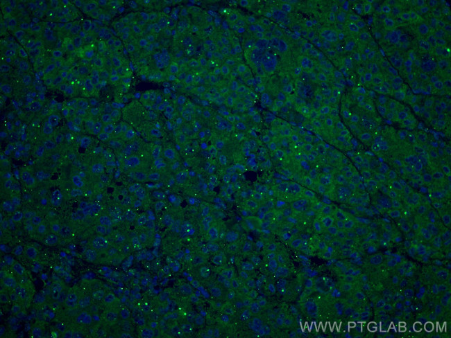 Transferrin Antibody in Immunohistochemistry (PFA fixed) (IHC (PFA))