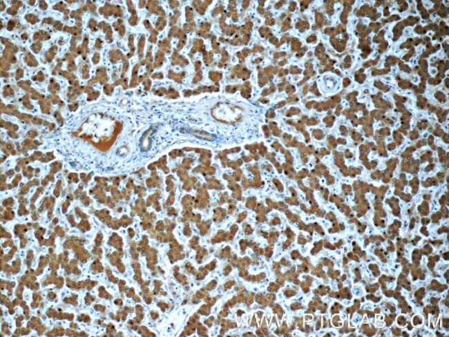 Transferrin Antibody in Immunohistochemistry (Paraffin) (IHC (P))