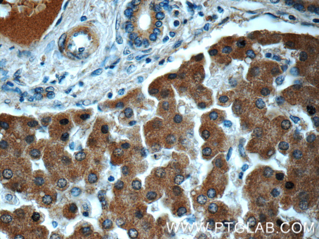 Transferrin Antibody in Immunohistochemistry (Paraffin) (IHC (P))