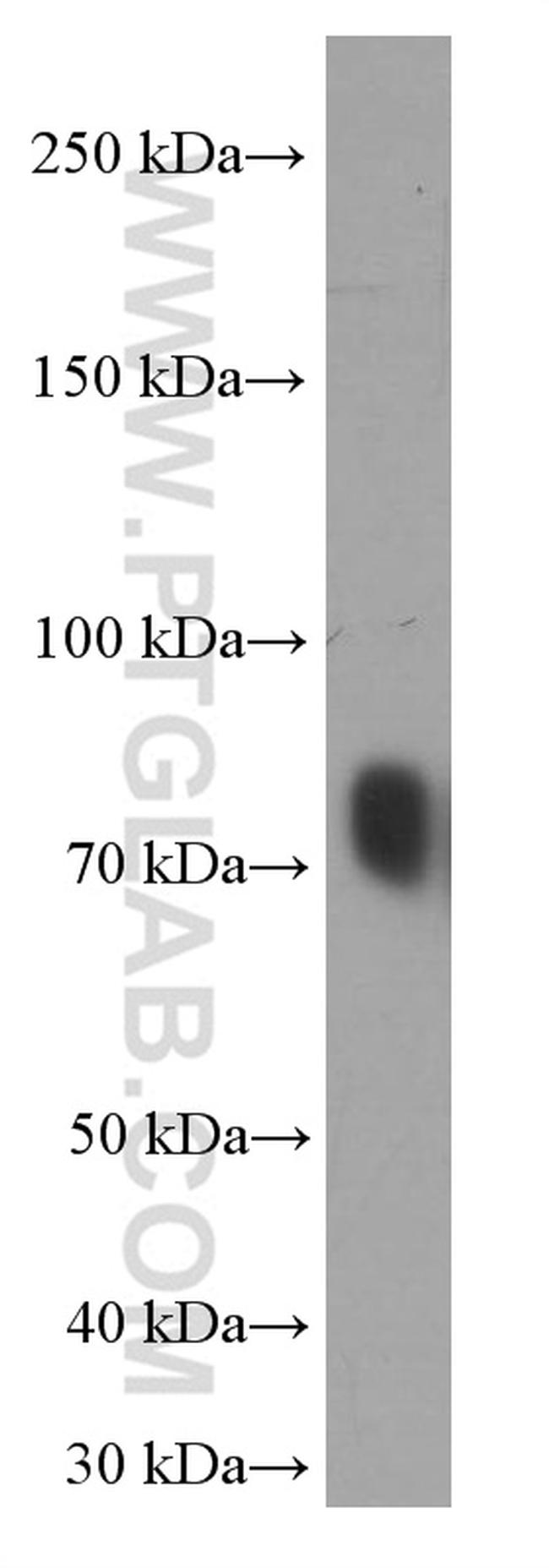 Transferrin Antibody in Western Blot (WB)