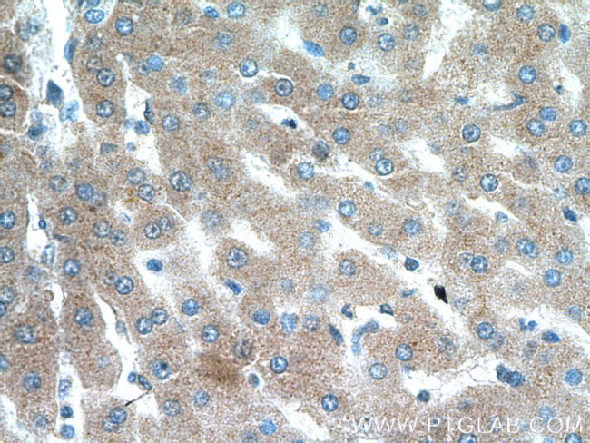 Transferrin Antibody in Immunohistochemistry (Paraffin) (IHC (P))