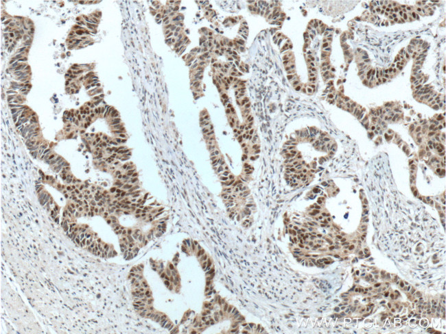 MSH6 Antibody in Immunohistochemistry (Paraffin) (IHC (P))