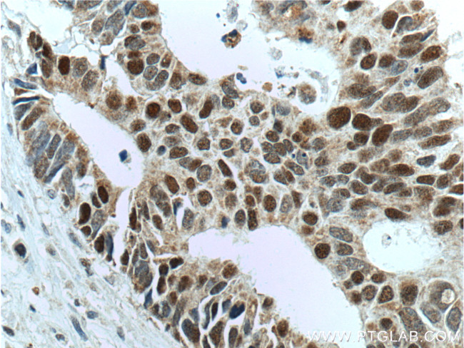 MSH6 Antibody in Immunohistochemistry (Paraffin) (IHC (P))