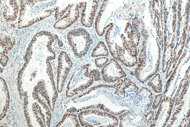 MSH6 Antibody in Immunohistochemistry (Paraffin) (IHC (P))