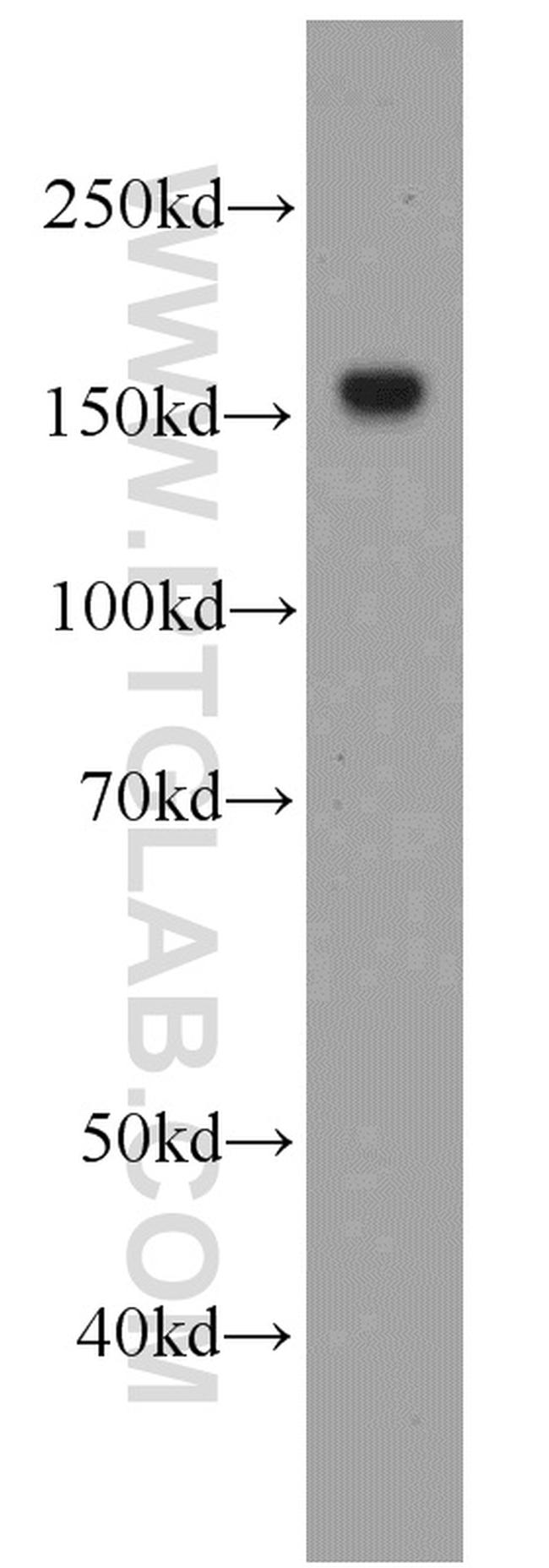 MSH6 Antibody in Western Blot (WB)