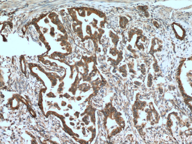 CNPY2/MSAP Antibody in Immunohistochemistry (Paraffin) (IHC (P))