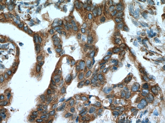 CNPY2/MSAP Antibody in Immunohistochemistry (Paraffin) (IHC (P))