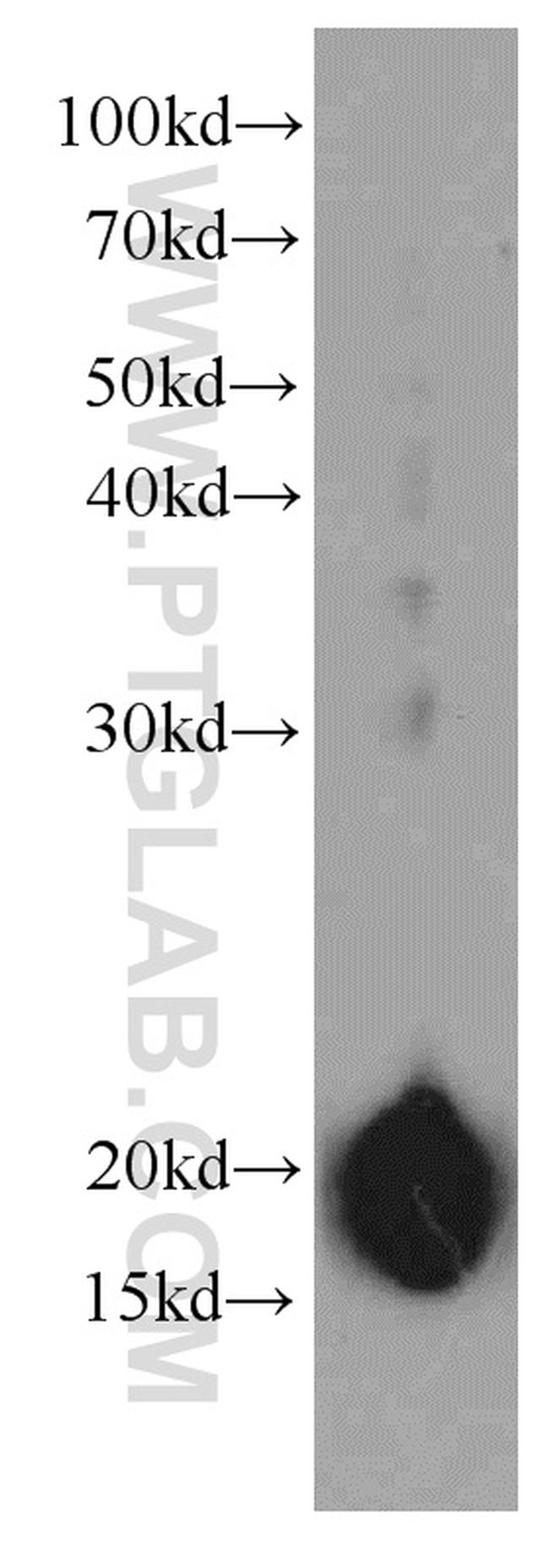 CNPY2/MSAP Antibody in Western Blot (WB)