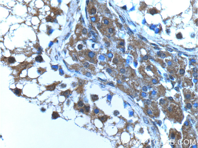 USP13 Antibody in Immunohistochemistry (Paraffin) (IHC (P))