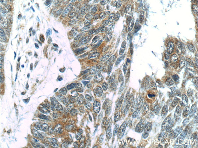 USP13 Antibody in Immunohistochemistry (Paraffin) (IHC (P))