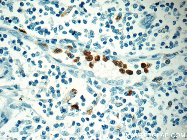 MPO Antibody in Immunohistochemistry (Paraffin) (IHC (P))