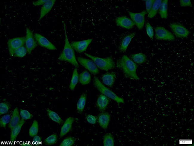 PSMD4 Antibody in Immunocytochemistry (ICC/IF)