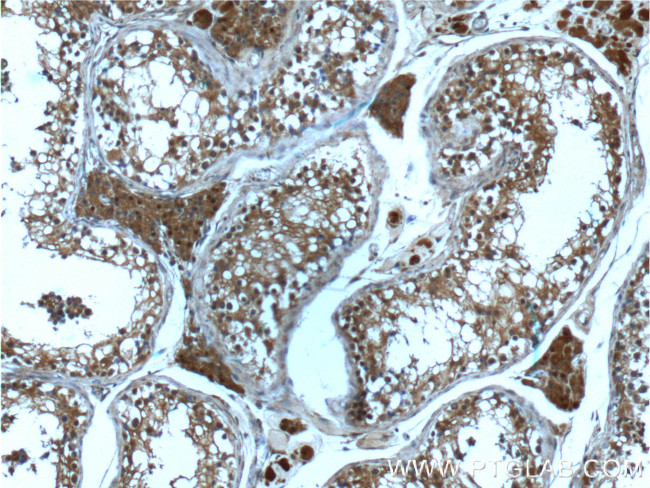 PSMD4 Antibody in Immunohistochemistry (Paraffin) (IHC (P))