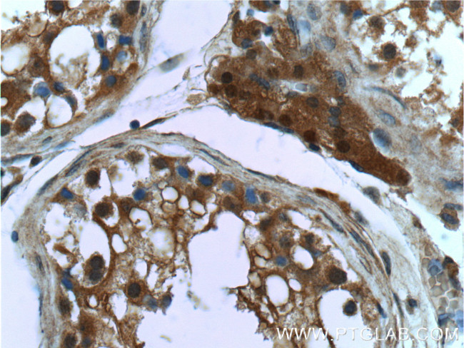 PSMD4 Antibody in Immunohistochemistry (Paraffin) (IHC (P))