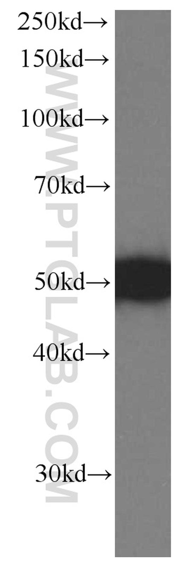 PSMD4 Antibody in Western Blot (WB)