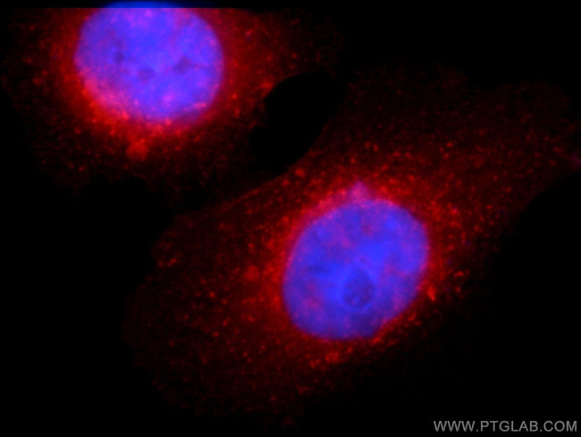 CD71 Antibody in Immunocytochemistry (ICC/IF)