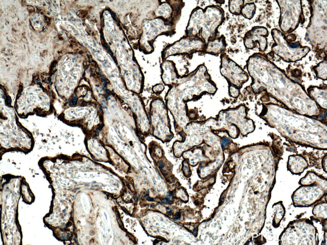 CD71 Antibody in Immunohistochemistry (Paraffin) (IHC (P))