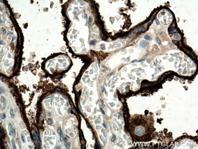 CD71 Antibody in Immunohistochemistry (Paraffin) (IHC (P))