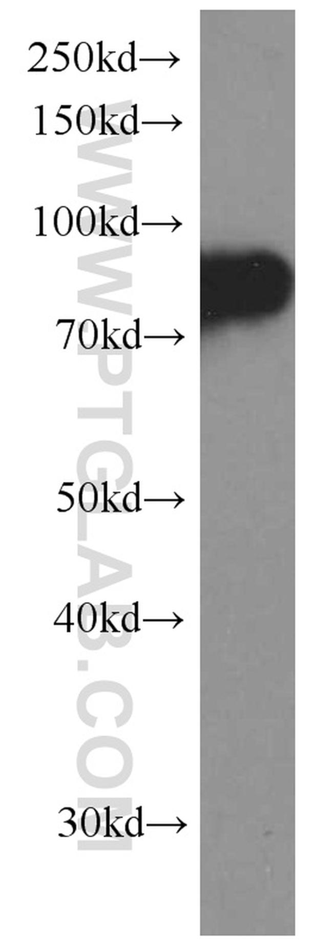 CD71 Antibody in Western Blot (WB)