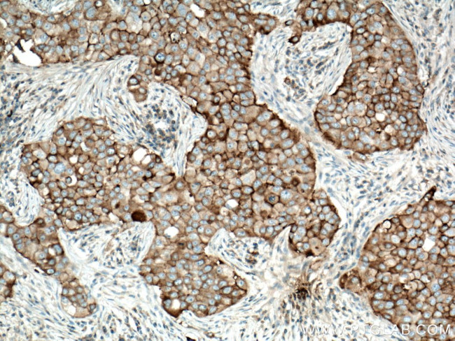 CD71 Antibody in Immunohistochemistry (Paraffin) (IHC (P))