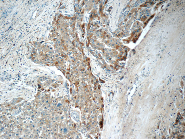 LBP Antibody in Immunohistochemistry (Paraffin) (IHC (P))