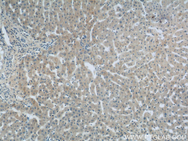 LBP Antibody in Immunohistochemistry (Paraffin) (IHC (P))