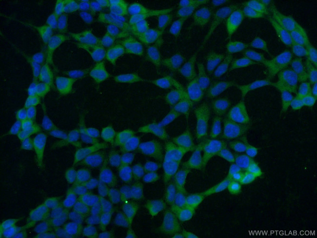 HSP70 Antibody in Immunocytochemistry (ICC/IF)