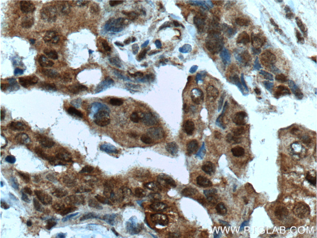 HSP70 Antibody in Immunohistochemistry (Paraffin) (IHC (P))