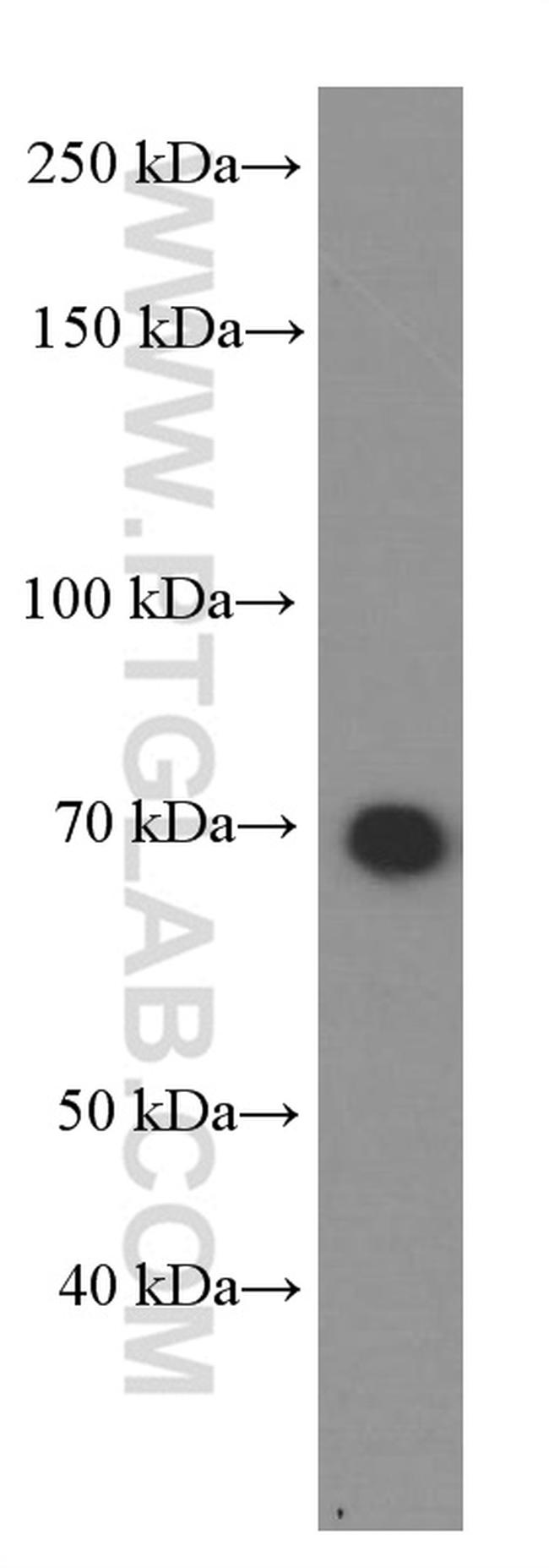 HSP70 Antibody in Western Blot (WB)