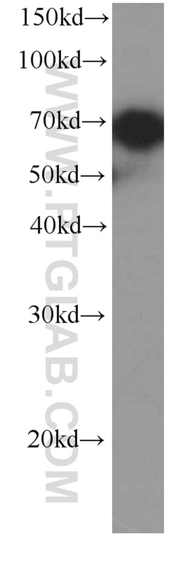 HSP70 Antibody in Western Blot (WB)