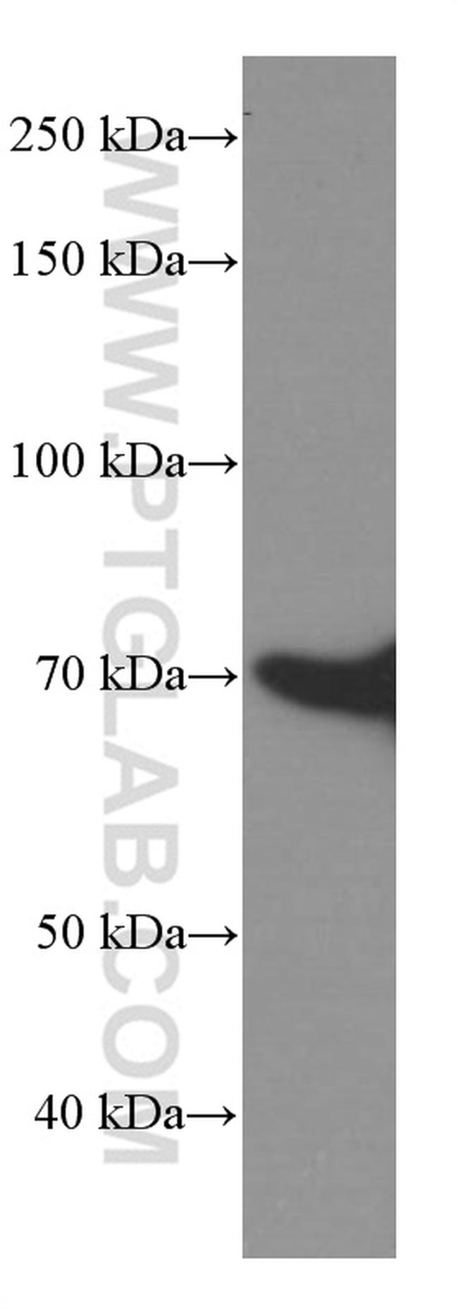 HSP70 Antibody in Western Blot (WB)