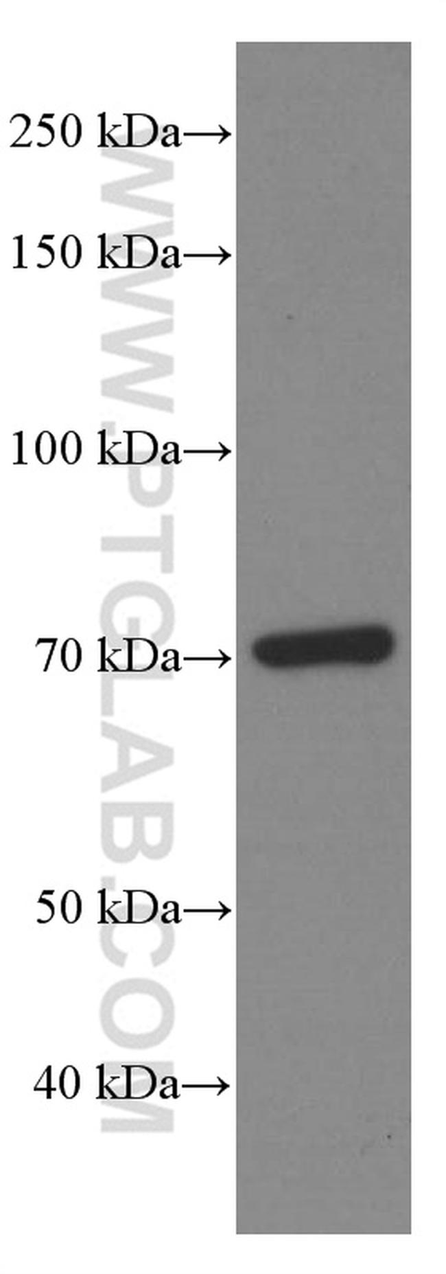 HSP70 Antibody in Western Blot (WB)