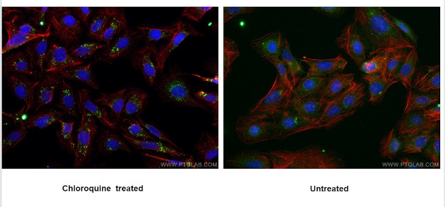 P62/SQSTM1 Antibody in Immunocytochemistry (ICC/IF)